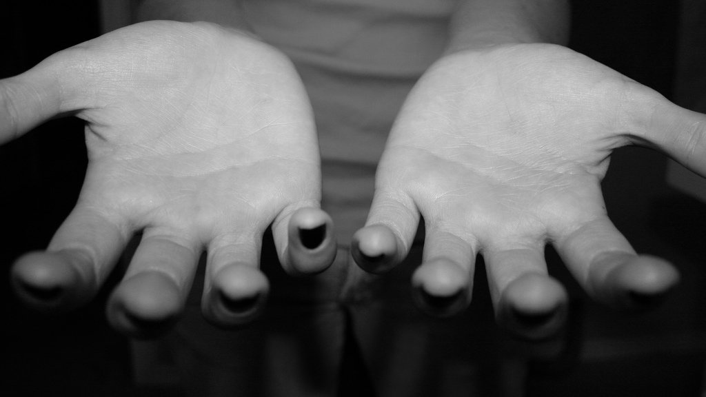 Rise in human trafficking victims in Ireland: Report